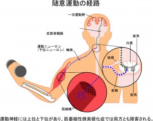 運動ニューロン疾患（特に筋萎縮性側索硬化症） | たくま内科・神経